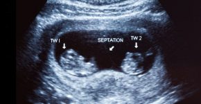 מה מחכה לנו בחוץ? אילוסטרציה: BigStock