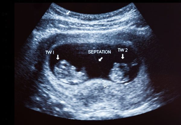 מה מחכה לנו בחוץ? אילוסטרציה: BigStock