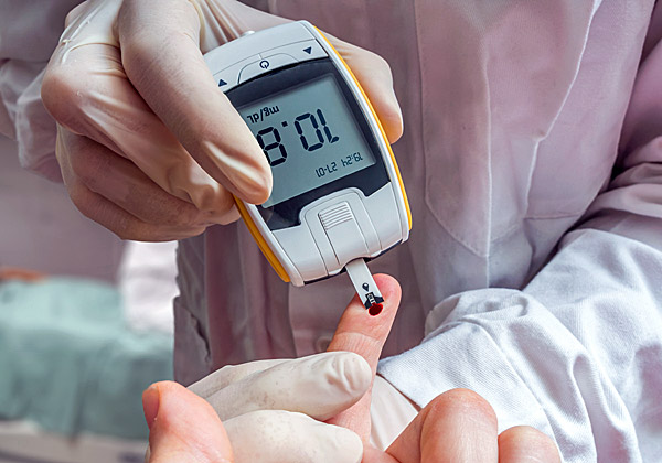 מדידת הגלוקוז בדם. פעולה יומיומית בסכרת. צילום אילוסטרציה: BigStock