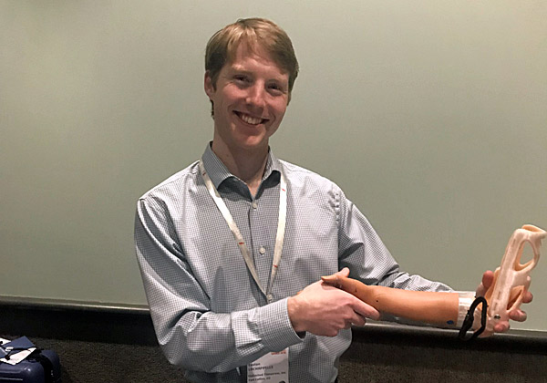 אוסטין לה-שאפל והיד התותבת. צילום: נחמה אלמוג