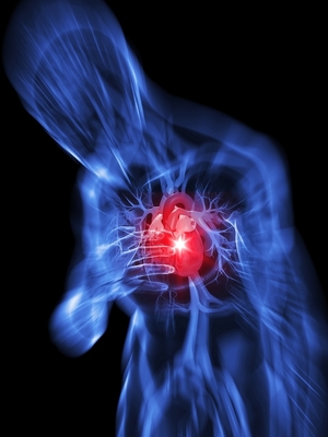 פרפור פרוזדורים (AFib) - תופעה שכיחה האחראית לאחד מכל 5 התקפי לב. צילום אילוסטרציה: BigStock