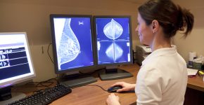 ה-AI מצליחה יותר. בדיקת ממוגרפיה לאיתור ואבחון מוקדם של סרטן השד. צילום אילוסטרציה: BigStock