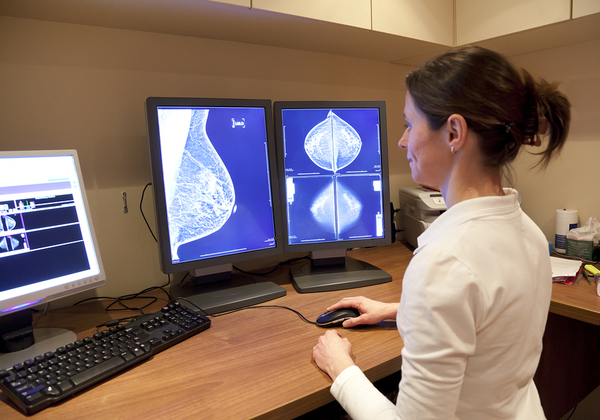 ה-AI מצליחה יותר. בדיקת ממוגרפיה לאיתור ואבחון מוקדם של סרטן השד. צילום אילוסטרציה: BigStock