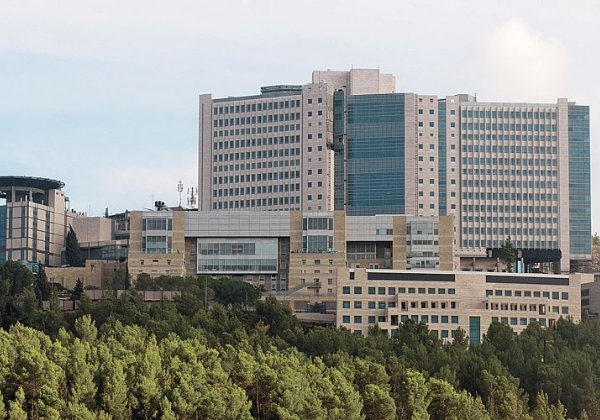 מרכז רפואי הדסה. צילום: יח"צ