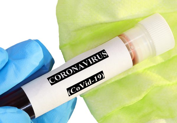 בדיקה סרולוגית לקורונה. צילום אילוסטרציה: BigStock