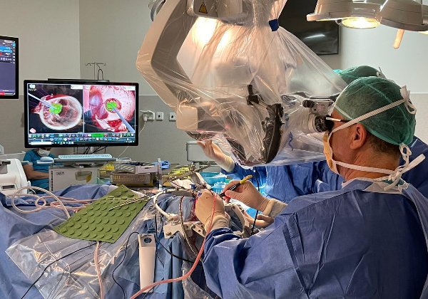 שימוש במערכת בעת ניתוח. צילום: סרג'יקל תיאט'ר