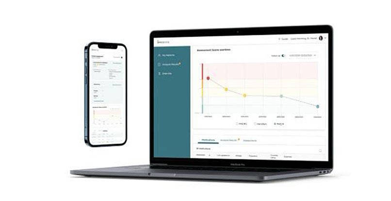 המערכת של טליאז