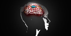 ממשק מוח/מחשב שמתרגם בזמן אמת מחשבה על דיבור - למילים באמצעות פענוח הפעילות העצבית במוח.